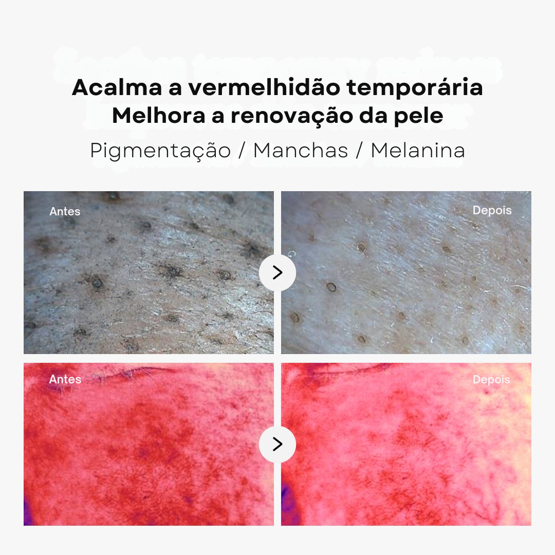 Discos Medicube Ácido Succínico com Pantenol