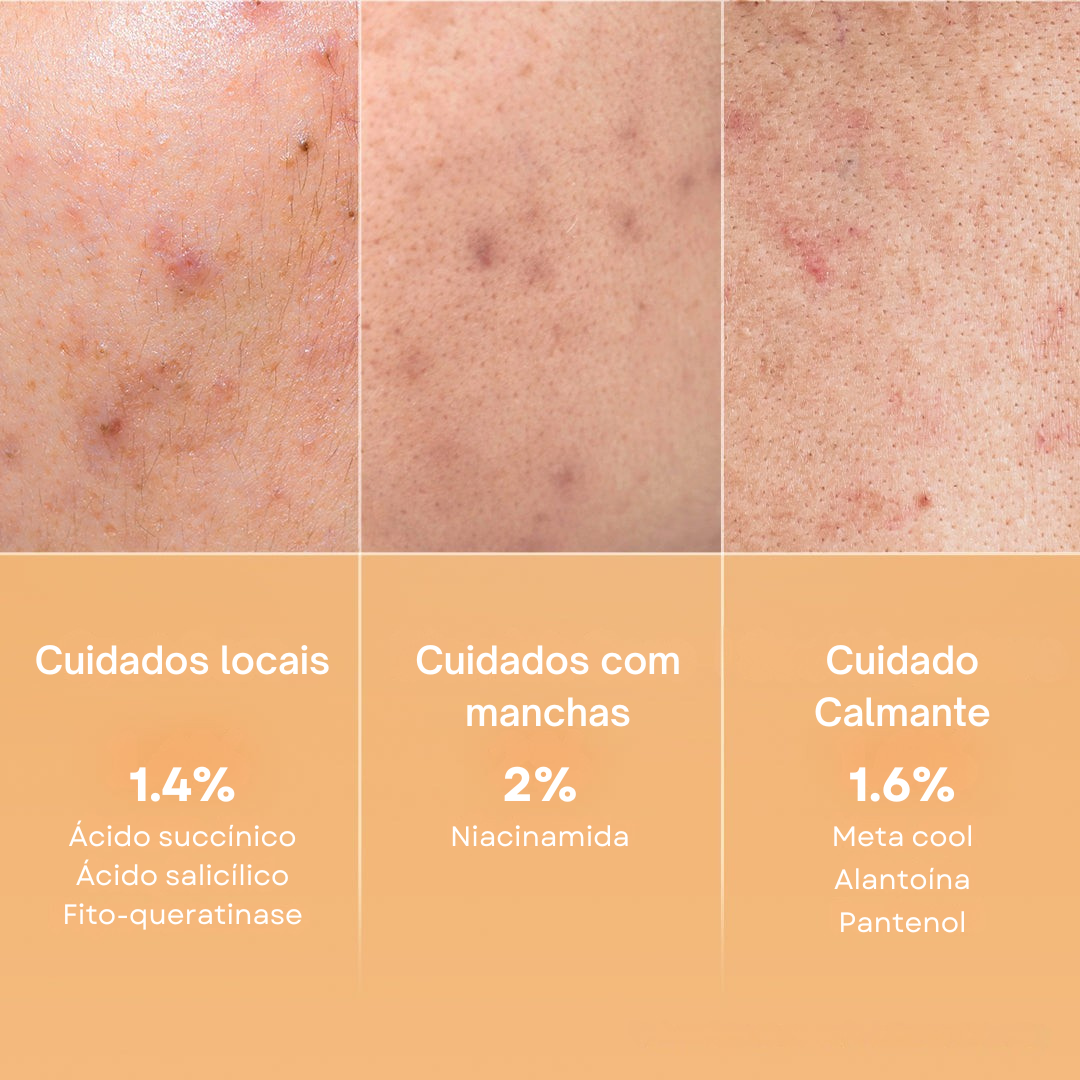 Discos Medicube Ácido Succínico com Pantenol