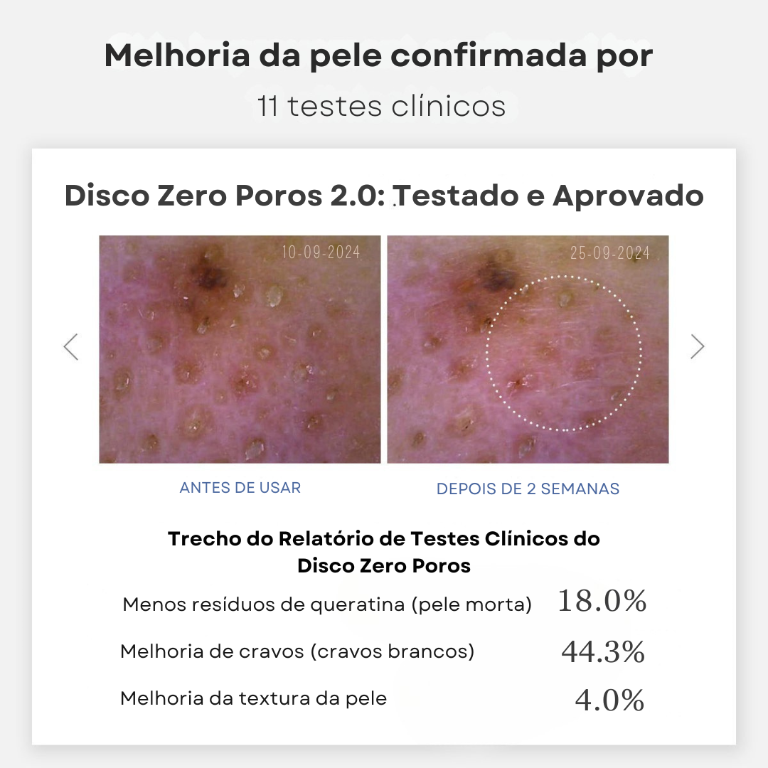 Discos Medicube Zero Pore 2.0