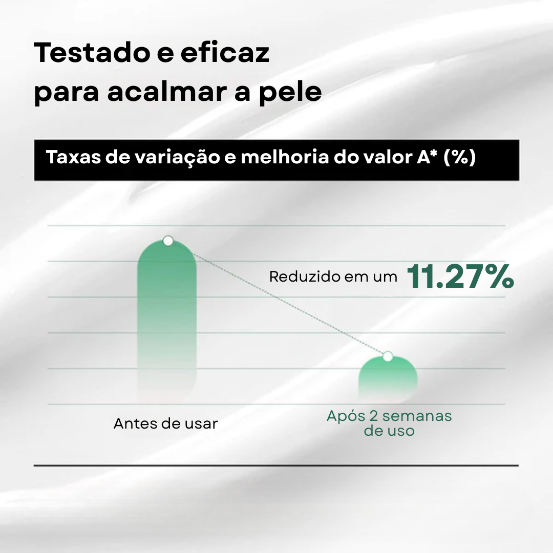 Anua Loção Diária Heartleaf 70%