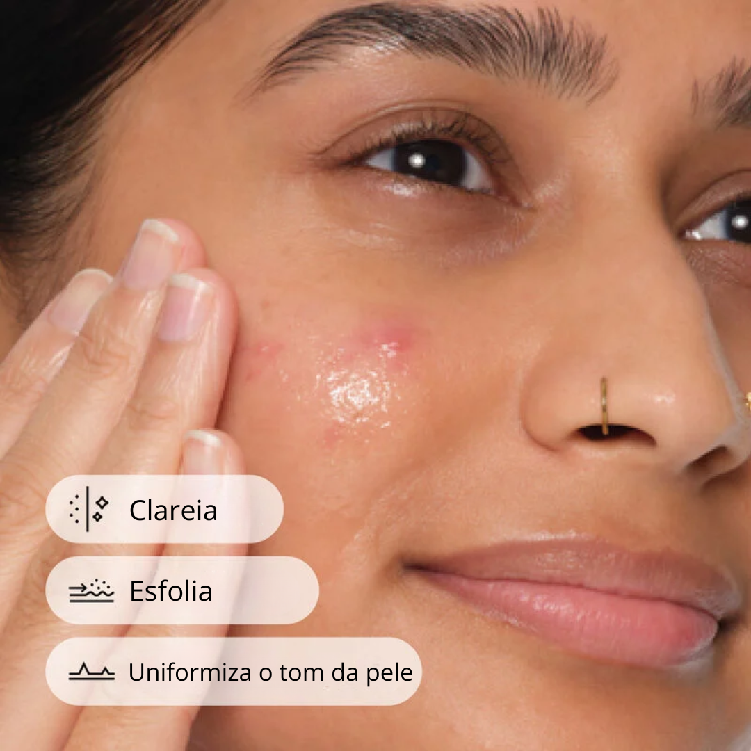 The Ordinary Salicylic Acid 2% Tratamento para Acne