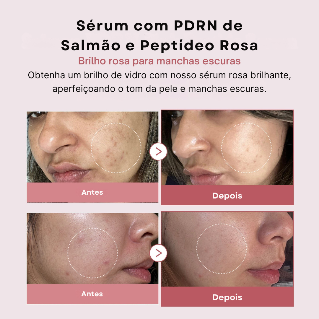 Sérum Medicube PDRN Peptide Pink