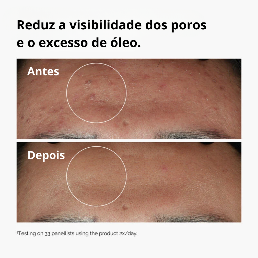 The Ordinary Niacinamide 10% Controle da Oleosidade